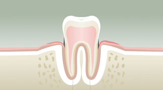 parodontologie2