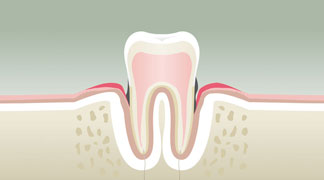 parodontologie3