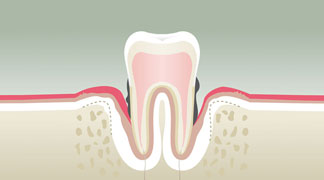 parodontologie4